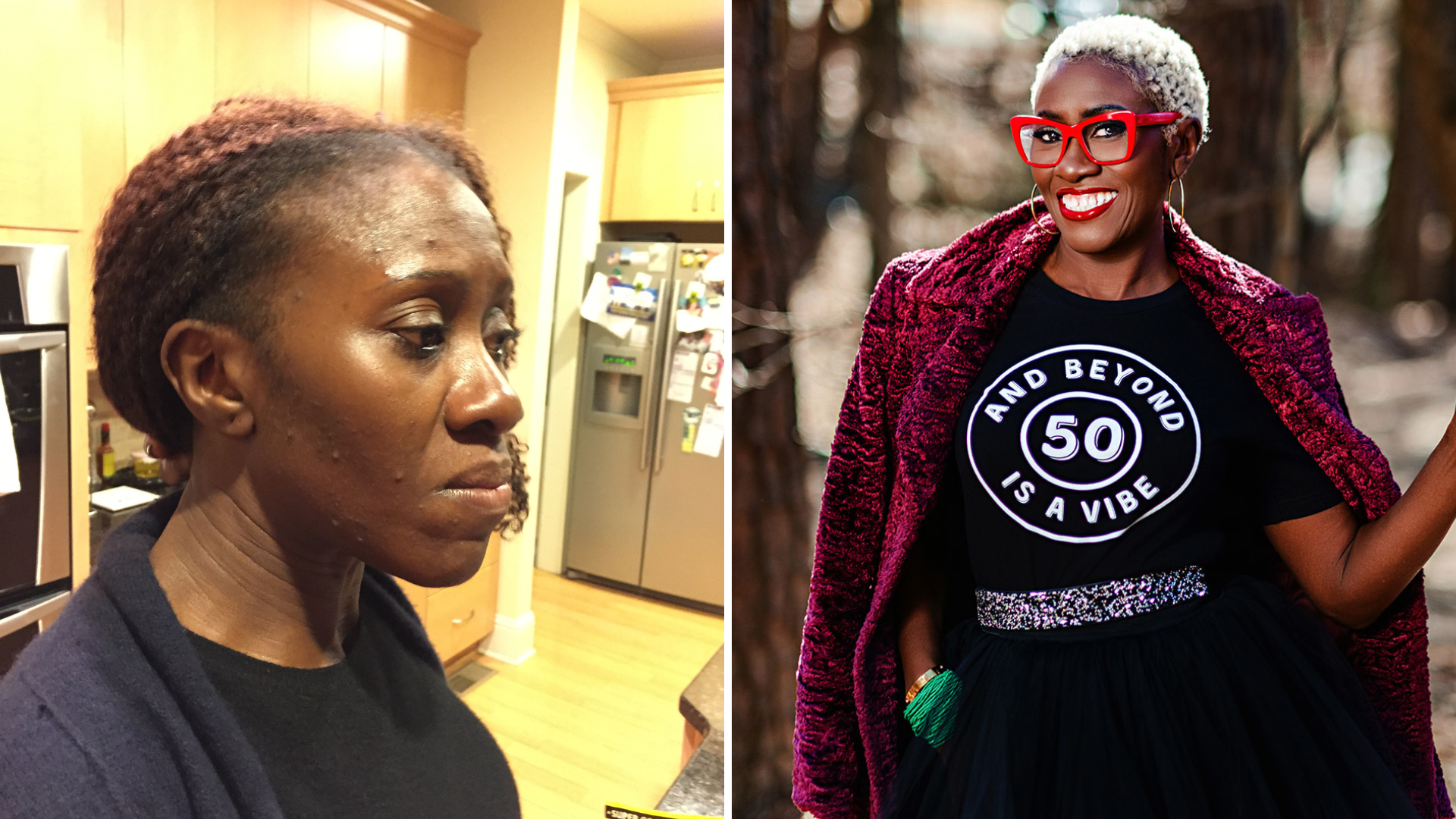 Kwavi before and after